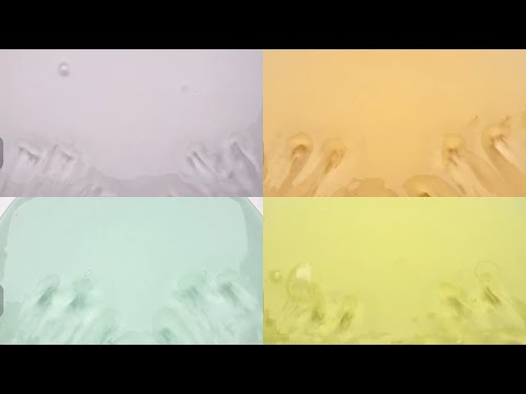 소규모시리즈 소규모 시리즈액괴 최있일 시리즈액괴 최근에 있었던 일 시리즈 액괴 드라마