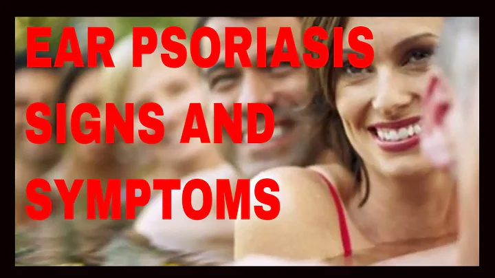 Ear Psoriasis Signs and Symptoms