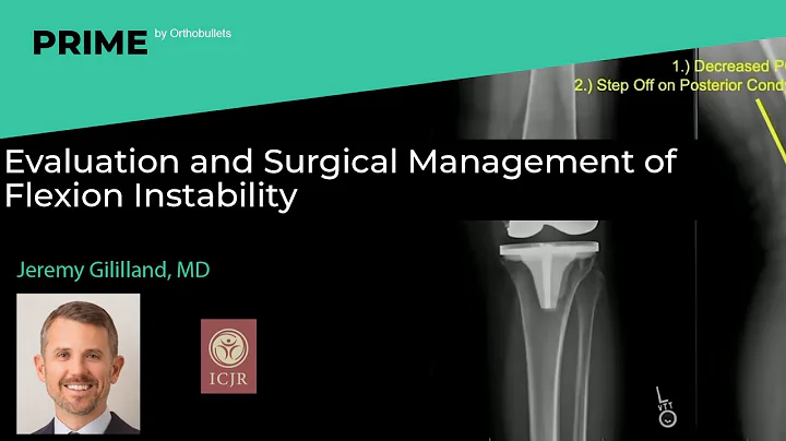 Evaluation and Surgical Management of Flexion Instability - Jeremy Gililland, MD