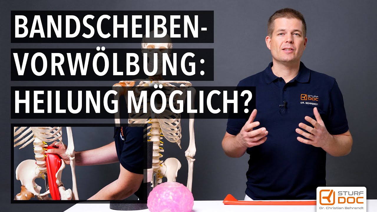 Was schmerzt an einer Bandscheibenvorwölbung oder Bandscheibenprotrusion?