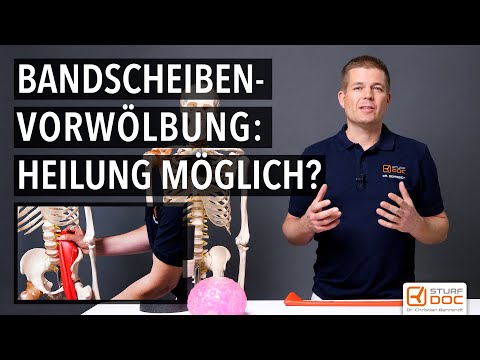 Video: Wird die extrudierte Bandscheibe heilen?