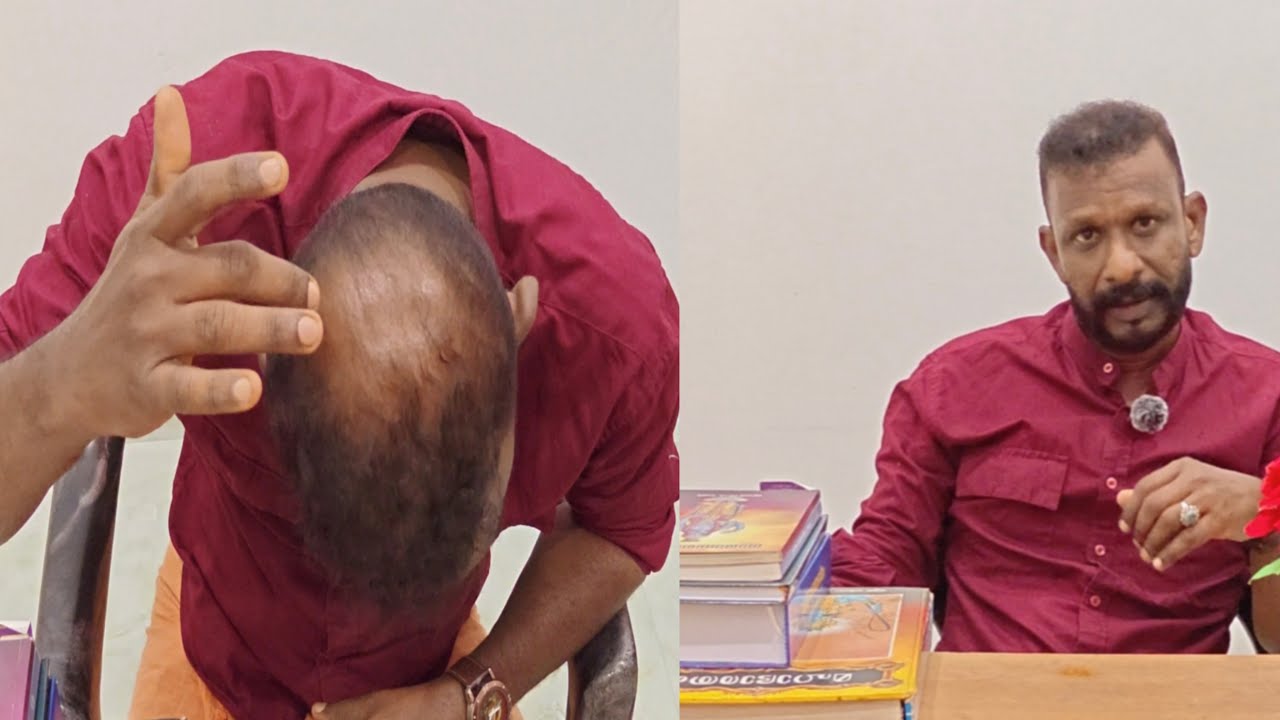 സംശയത്തിനുള്ള മറുപടി | Hair transplant | Comment Review |