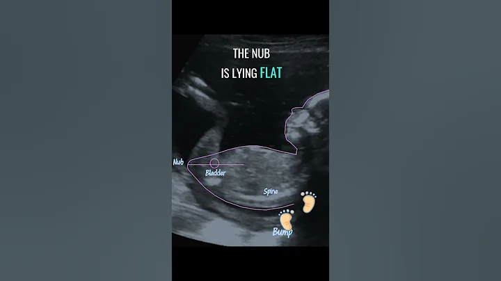 Gender reveal with NubX!