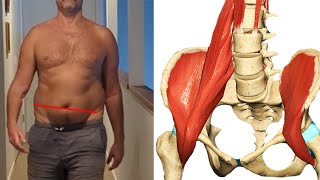 One-Sided Psoas Pain & Pelvis tilt SOLUTION (2 exercises to fix Left AIC pattern)