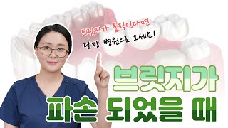 What to Do When Your Dental Bridge Breaks !!!Why You Must See a Dentist Immediately If Your Bridg...