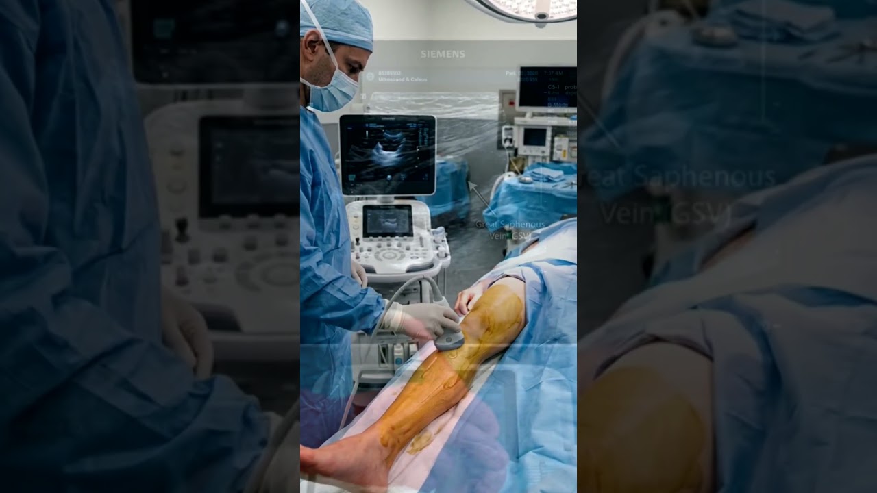 Operation Theatre me Varicose Veins ka Laser Treatment | EVLT Procedure Explained