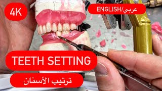 Teeth setting 101ترتيب الأسنان