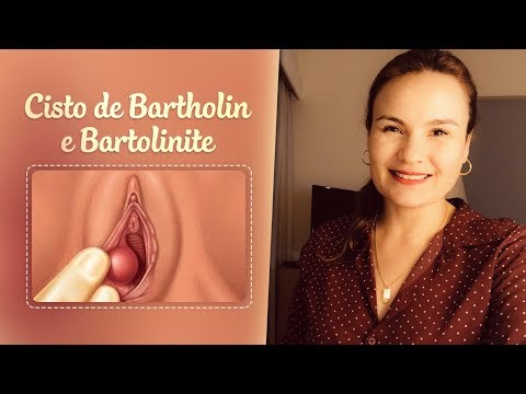 Entenda a diferença entre Cisto de Bartholin e Bartolinite