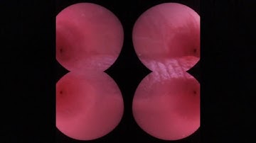 CHAT NOIR / HYPERURANION - N2