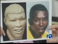 Facial reconstructions help solve cases