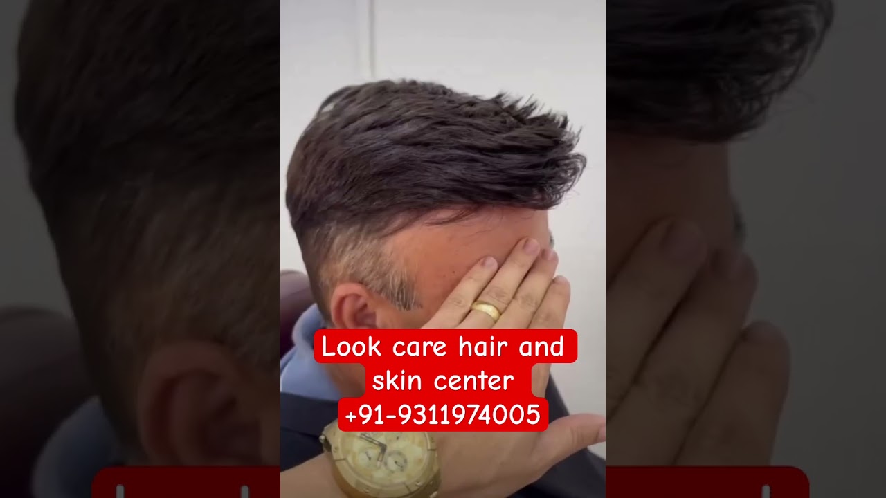 Australian hair patch | Natural Looking Hair Patch | Best Hair Patch Service 