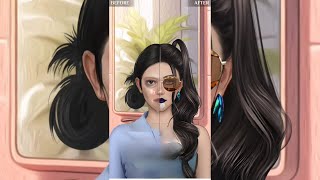 Pimple Injection Makeover Skin Transformation