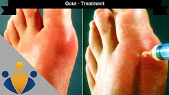 Gout treatment: How to Cure Gout in 24 hours Naturally 🎁 🎁 🎁
