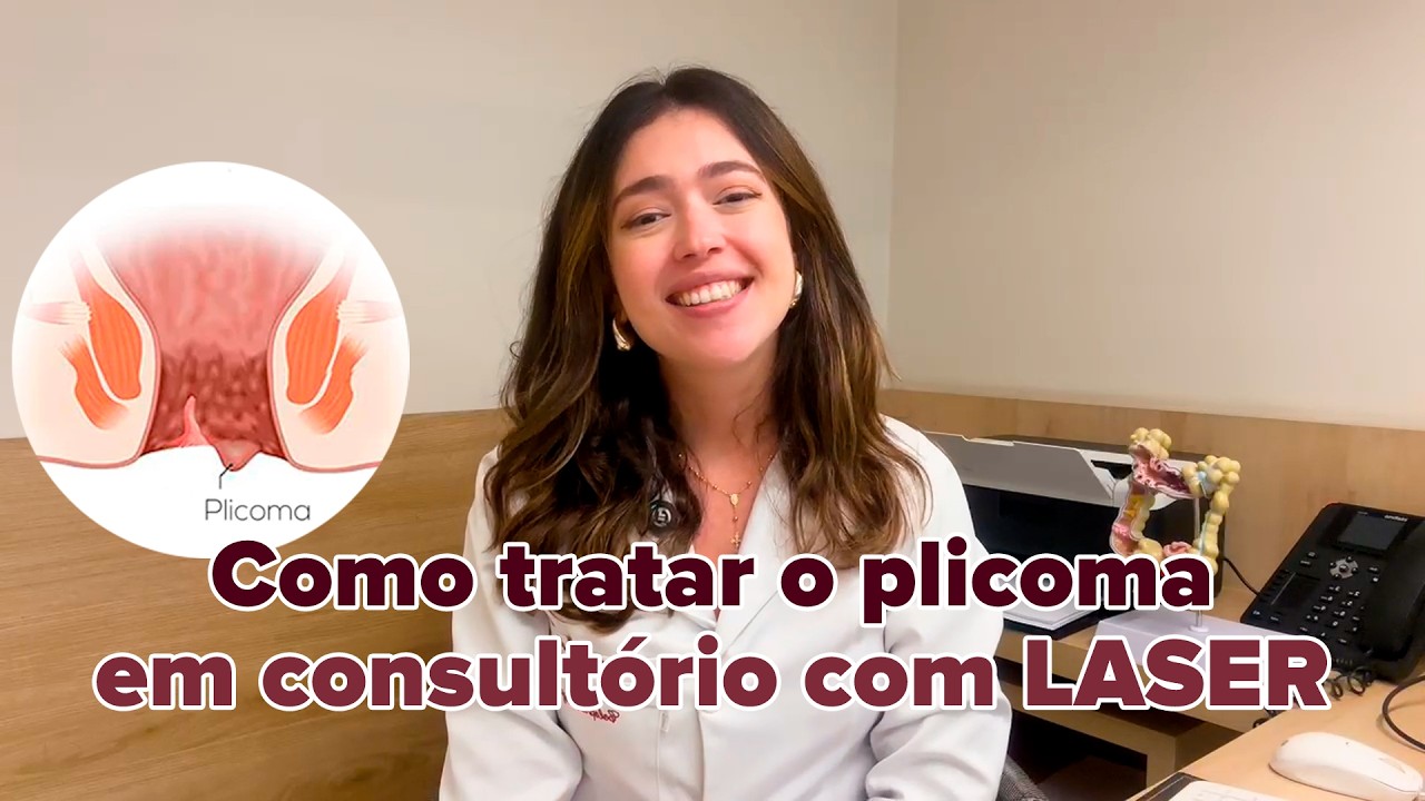 Você já percebeu uma pequena pele na região do ânus que causa incômodo durante a higiene ou até mesmo ao longo do dia? Apesar de muitas pessoas não conhecerem o nome, essa alteração é relativamente comum e recebe o nome de plicoma anal. Em alguns casos, essa pequena dobra de pele pode provocar desconforto, dificuldade na higiene íntima, irritação e coceira, interferindo na qualidade de vida e no bem-estar.