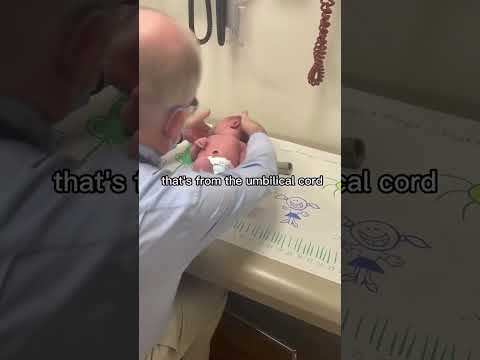 वीडियो: न्यूबर्न चेक अप: आपके बेबी का पहला अस्पताल टेस्ट