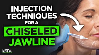 How to Get Rid of Jowls with Filler | Full Procedure Demonstration