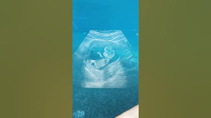 Längtar så mycket efter dig 🥰 #gravid #shorts