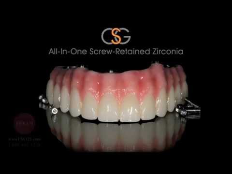 Csg All In One Screw Retained Zirconia Youtube