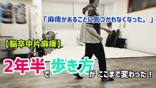 「麻痺があることに気づかれなくなった。」【脳卒中片麻痺】2年半で歩き方がここまで変わった