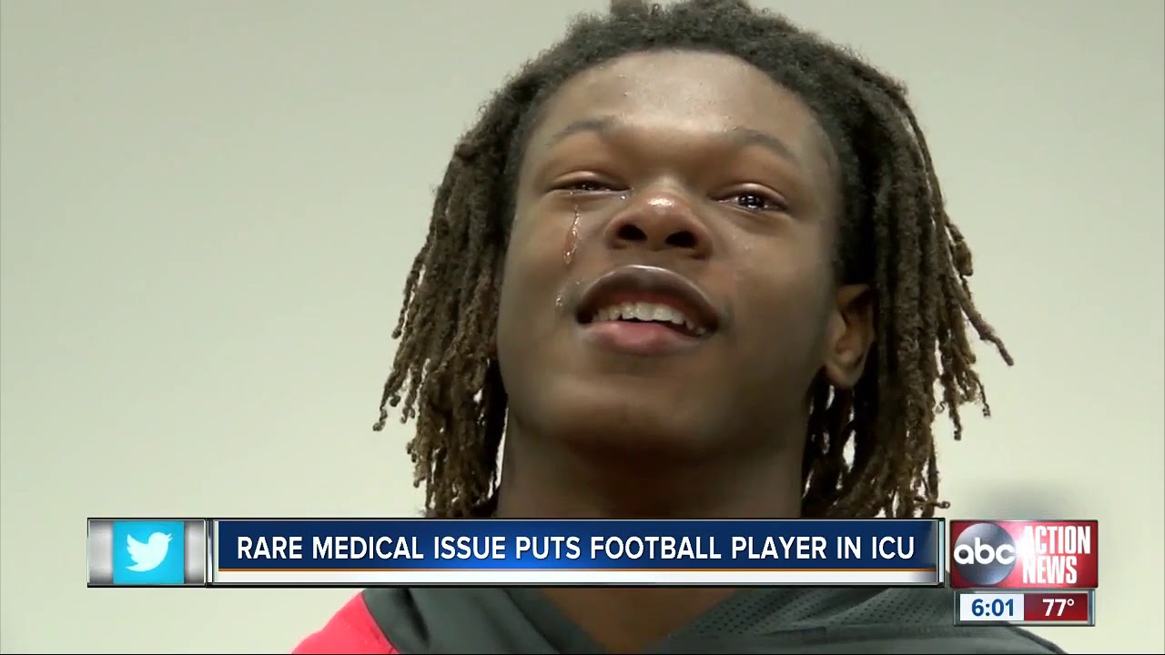 television reddit Family, friends praying for Northeast High football player in ICU from brain condition