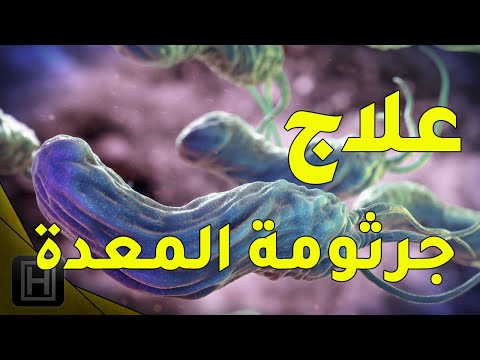 اعراض جرثومة المعدة وعلاجها بأقوى المواد الموجودة في الطبيعية
