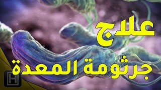 اعراض جرثومة المعدة وعلاجها بأقوى المواد الموجودة في الطبيعية