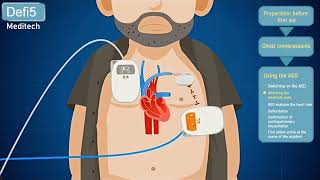 Aed Essentials Empowering You To Learn Cpr And Save Lives Step-By-Step Tutorial