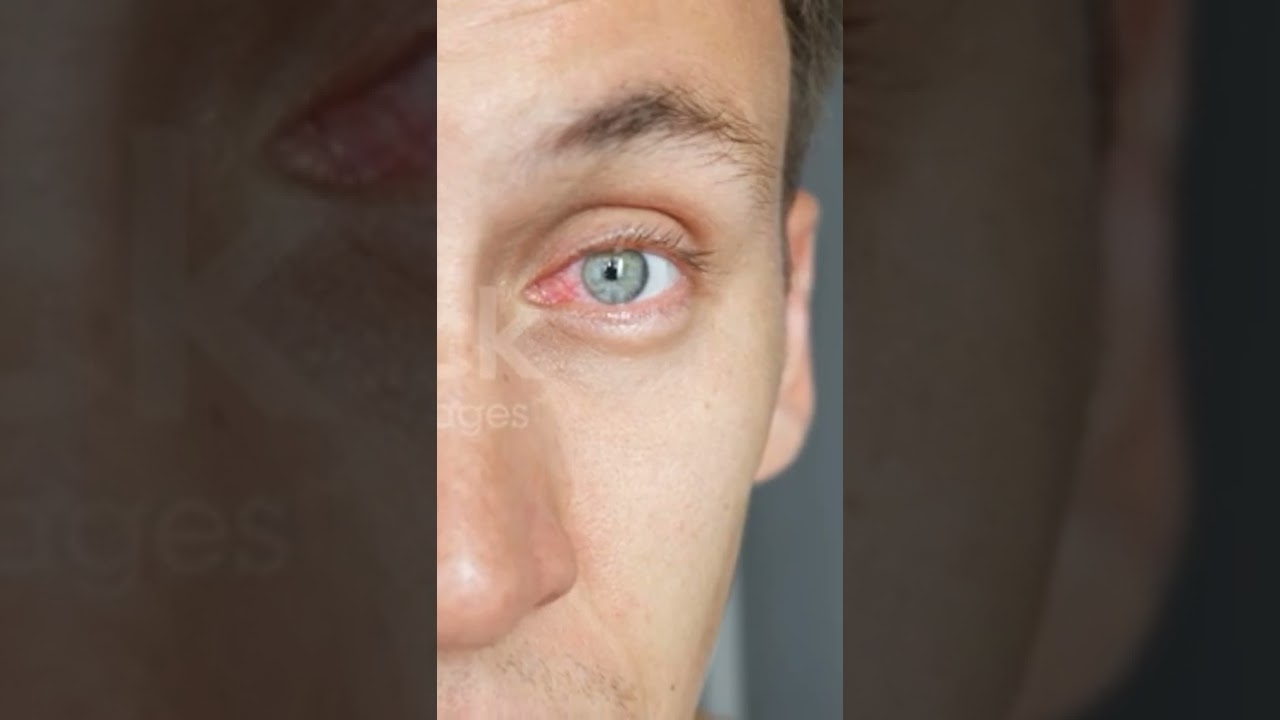 Snake bite treatment 