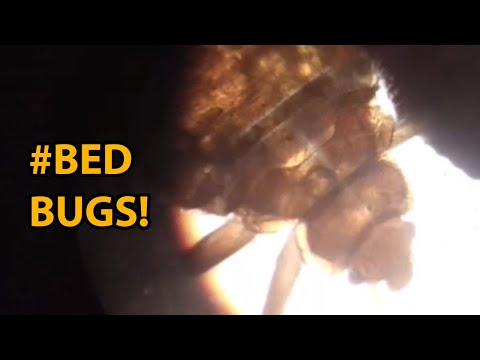 Catching and investigating Bed Bugs or Bat Bugs (microscopy)