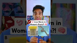 😱 Doctor Reacts: Live Worm in Woman’s BRAIN 🪱🧠