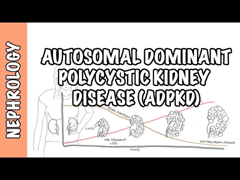 Autosomal Dominant Polycystic Kidney Disease (ADPKD) - causes, pathophysiology, diagnosis, treatment