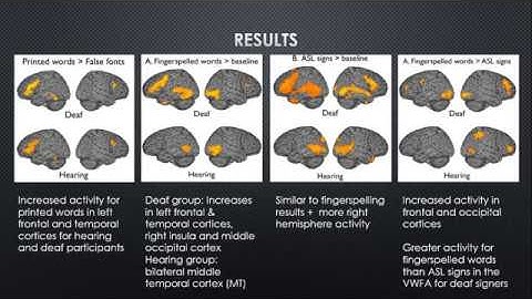 Neuroscience and ASL (PSYC59)