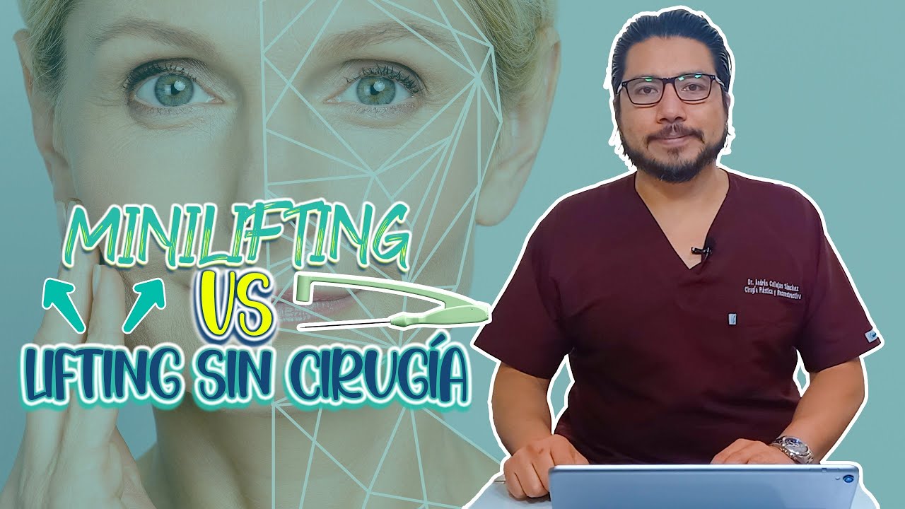 Diferencias entre Minilifting y FaceTite - Rejuvenecimiento facial