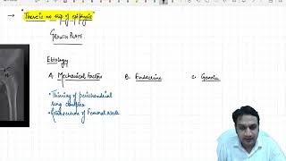 SCFE - Slipped capital femoral epiphysi