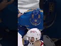 Toropchenko blocks shot with face