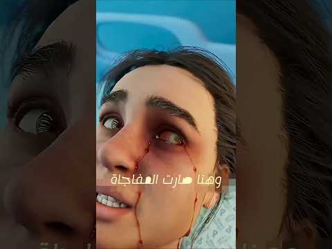 بنت خسرت عينة بسبب الدكتور ريلز اكسبلور تيك توك  ترند قصص العاب شفا 