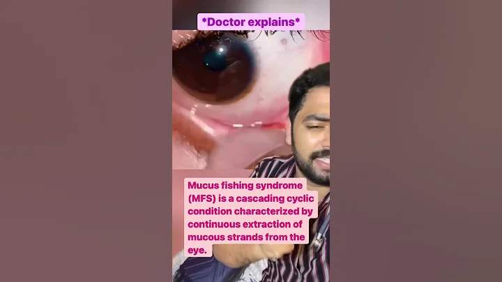 Doctor explains: Mucus Fishing 🎣 #shorts #doctorreacts #drfaem #mucusfishing