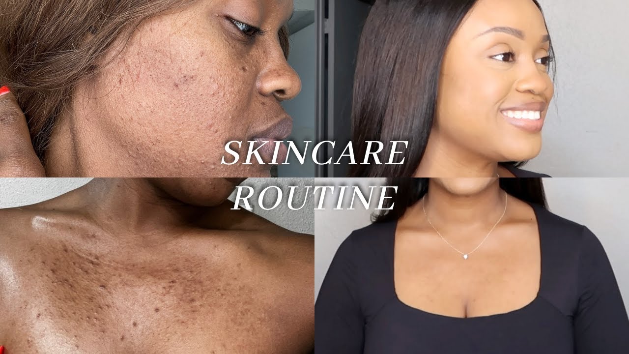 The BEST SKINCARE ROUTINE to Clear Hyperpigmentation, Dark Spots, and ...