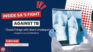 Inside South Africa’s Fight Against Tuberculosis