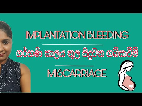 Implantation Bleeding & Miscarriages | රුධිර පිටවීමකින් හදුනාගන්නා ගැබ්ගැනිම හා ගබ්සාවීම් හදුනාගැනිම