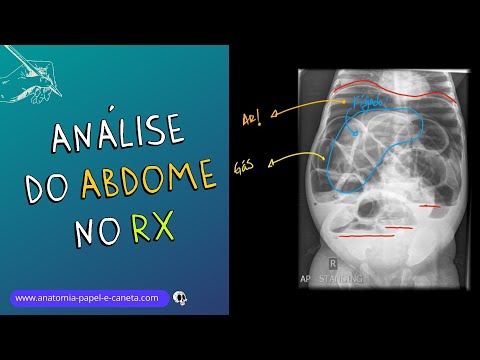 Learn how to analyze an abdominal X-ray exam