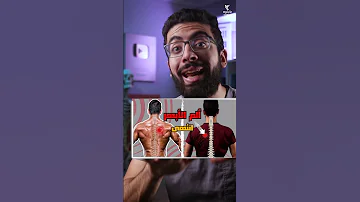 السبب الخفي وراء آلام الأبهر 