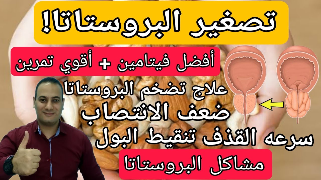 أفضل فيتامين لتصغير البروستاتا مهما كان حجمها | علاج طبيعي لتضخم البروستاتا الحميد |علاج تنقيط البول