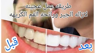 وصفه لازاله جير الأسنان وعلاج اصفرار الأسنان وعلاج رائحه الفم الكريهه عجينه مضمونه وصفه مجربه