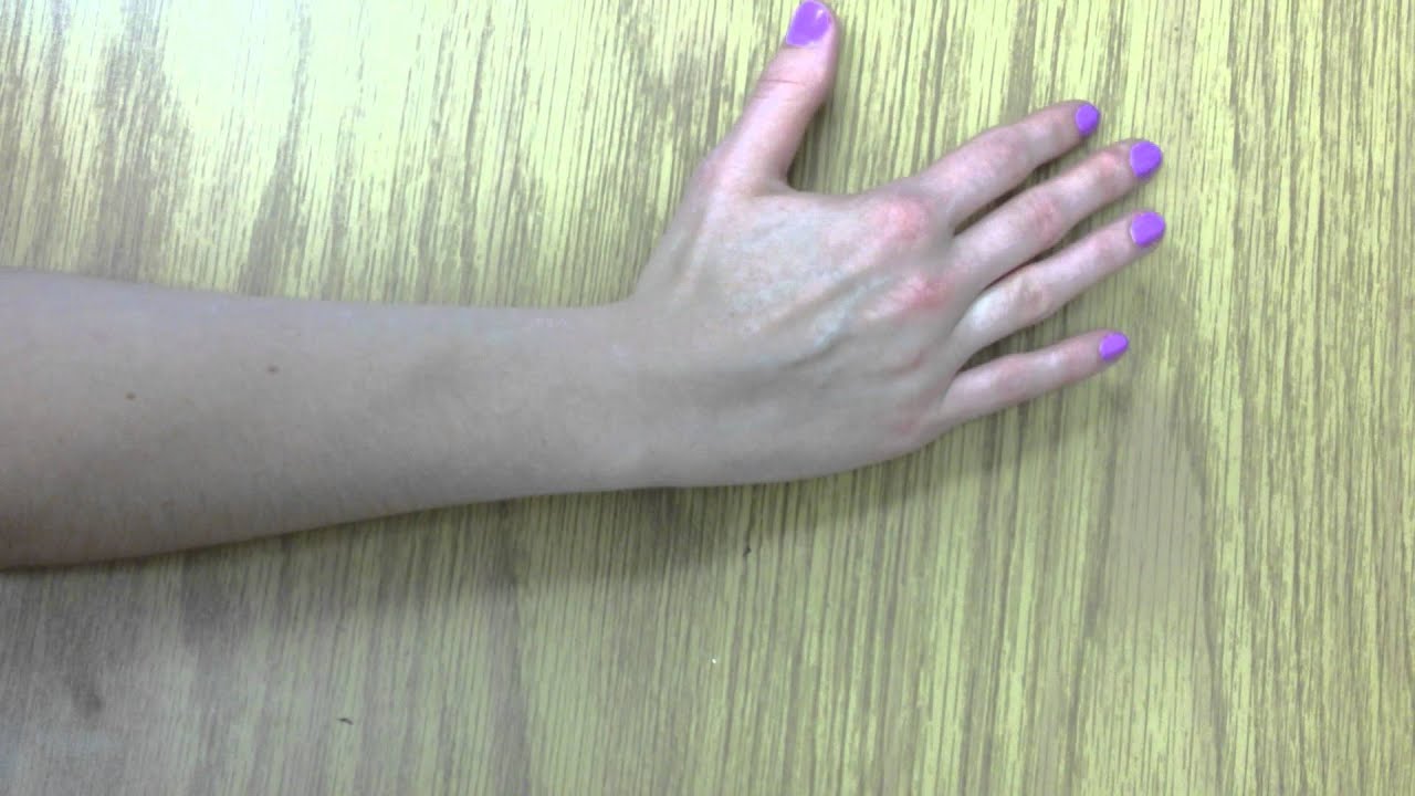 Wrist range of motion YouTube