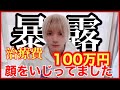 【ご報告】V系の宿命!?実は僕...顔をいじってました。【治療費総額100万円の整形!?】