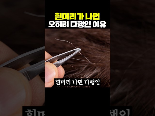흰머리가 나면 오히려 다행인 이유