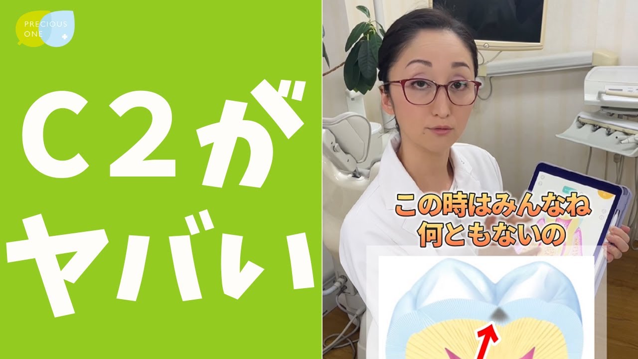 【実はヤバイ虫歯】歯科健診のＣ１、Ｃ２