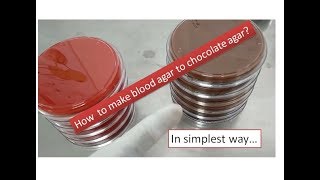 Chocolate agar preparation  |simplest way | Microbiology