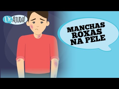 MANCHAS ROXAS NA PELE: O QUE PODE SER?